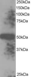 IHC-plus™ TXNDC5 / ERP46 Antibody (aa419-432)