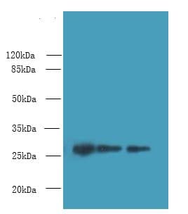 PEX11B Antibody