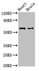 CYP3A4 / Cytochrome P450 3A4 Antibody