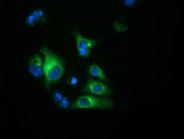 Monoclonal Mouse anti-Human HP / Haptoglobin Antibody (clone OTI4H5, IF, WB)