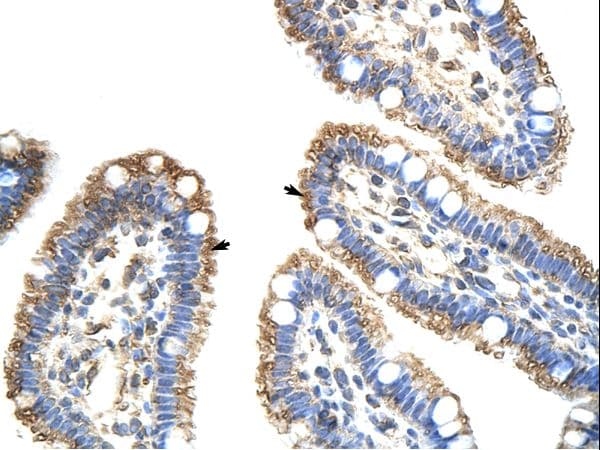 FZD9 / Frizzled 9 Antibody (aa181-230)