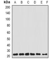 TAGLN2 / Transgelin 2 Antibody