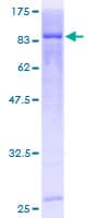 Human CDKN2AIP Protein (Recombinant GST)