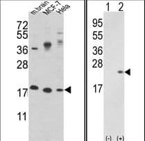 PathPlus™ Polyclonal Rabbit anti-Human CFL1 / Cofilin Antibody (aa4-32, IHC, WB)