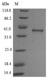 Bartonella henselae LIAS / LIP1 Protein (Recombinant 6His, N-terminus)