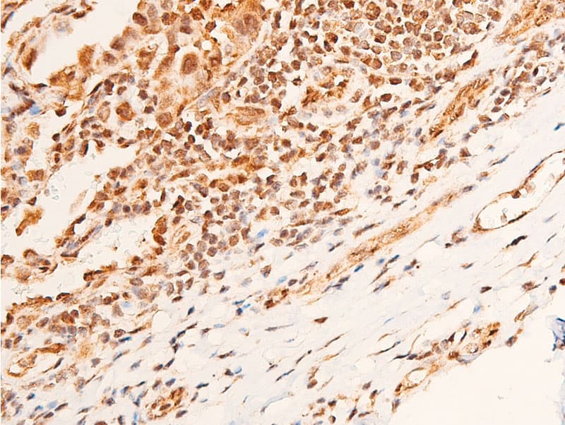 Polyclonal Rabbit anti-Human CHEK1 / CHK1 Antibody (phospho-Ser296, IHC, IF, WB)