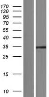 SAE1 Protein (Over-Expression Lysate Myc-DDK (Flag))
