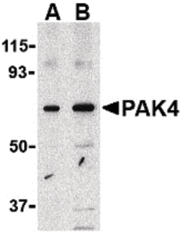 IHC-plus™ Polyclonal Rabbit anti-Human PAK4 Antibody (IHC, IF, WB)