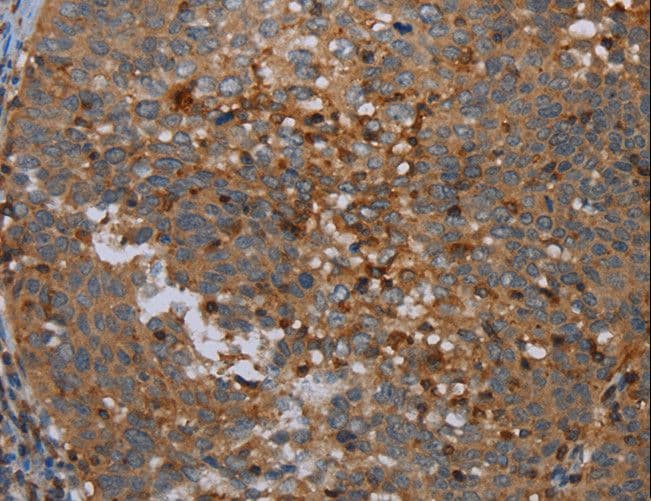 OTOR / Otoraplin Antibody