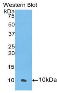SDF1 / CXCL12 Antibody (aa23-93)