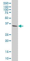 IHC-plus™ Monoclonal Mouse anti-Human GSC / Goosecoid Antibody (clone 2C1, IHC, WB)