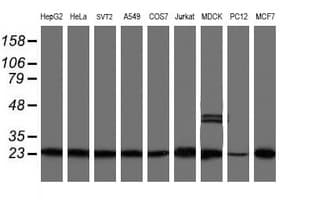 PSMB9 Antibody (clone OTI2B6)