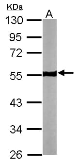 IHC-plus™ TUBB / Beta Tubulin Antibody (aa238-429)