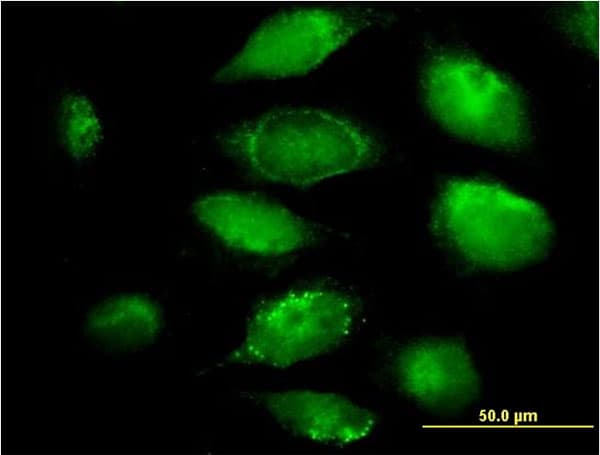 PLGLB2 / PLGLB1 Antibody (clone 3E6)