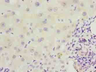 EFCAB12 / C3orf25 Antibody