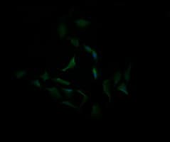 CA12 / Carbonic Anhydrase XII Antibody (clone OTI4D1)