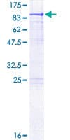 Human METTL3 Protein (Recombinant GST)