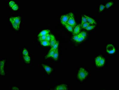 Polyclonal Rabbit anti-Human AIFM1 / AIF / PDCD8 Antibody (aa103-612)