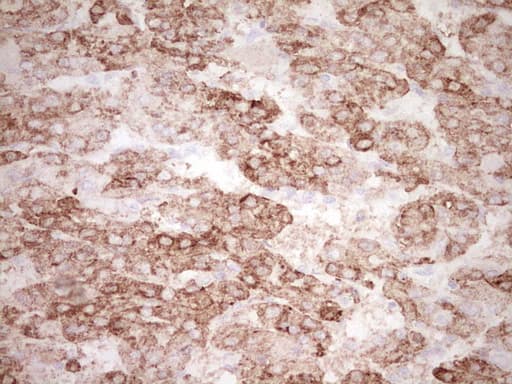 KLF2 Antibody (clone OTI6A3, Carrier-free)