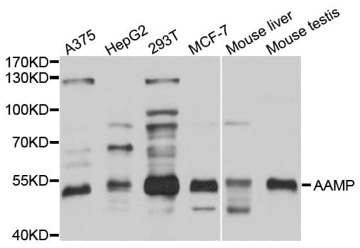 Polyclonal Rabbit anti-Human AAMP Antibody (WB)