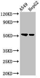 Polyclonal Rabbit anti-Human GCNT3 Antibody (IHC, WB)