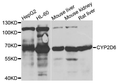 Polyclonal Rabbit anti-Human CYP2D6 Antibody (WB)