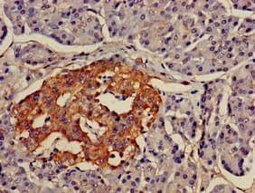LMX1A Antibody