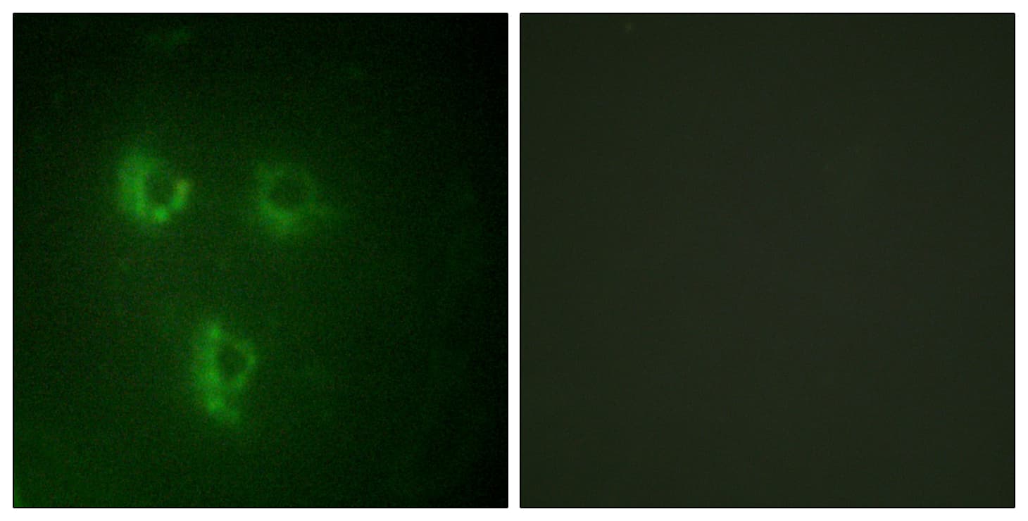 IHC-plus™ TMEPAI / PMEPA1 Antibody (aa101-150)