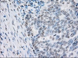 PSMA7 Antibody (clone OTI2A7, Carrier-free)