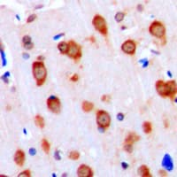 Polyclonal Rabbit anti-Human ACVRL1 Antibody (Internal, IHC, IF, WB)