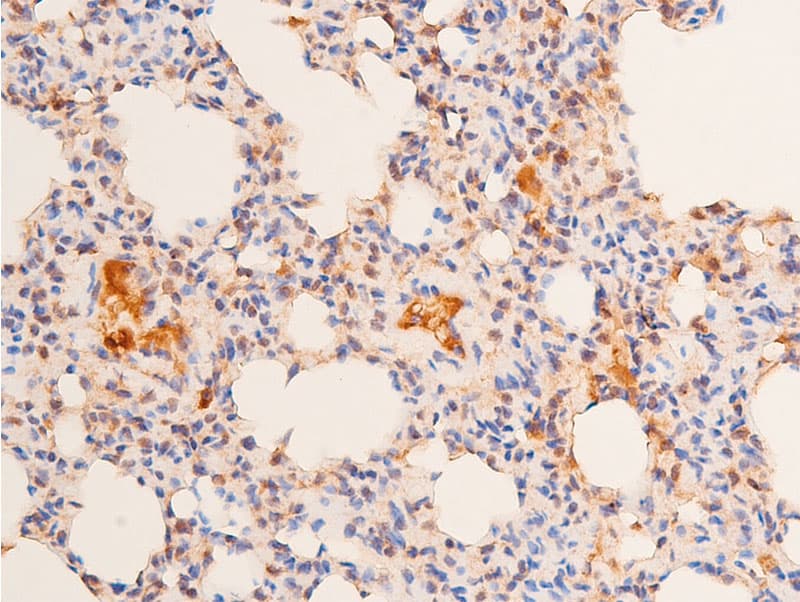 TP53 / p53 Antibody (phospho-Ser15)
