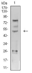 Monoclonal Mouse anti-Human TFAP2C / AP2 Gamma Antibody (clone 3A11A5, IHC, WB)
