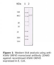 HHV-8 ORF45 Antibody (clone 2D4A5)