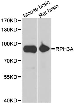Polyclonal Rabbit anti-Human RPH3A / Rabphilin 3A Antibody (IHC, WB)