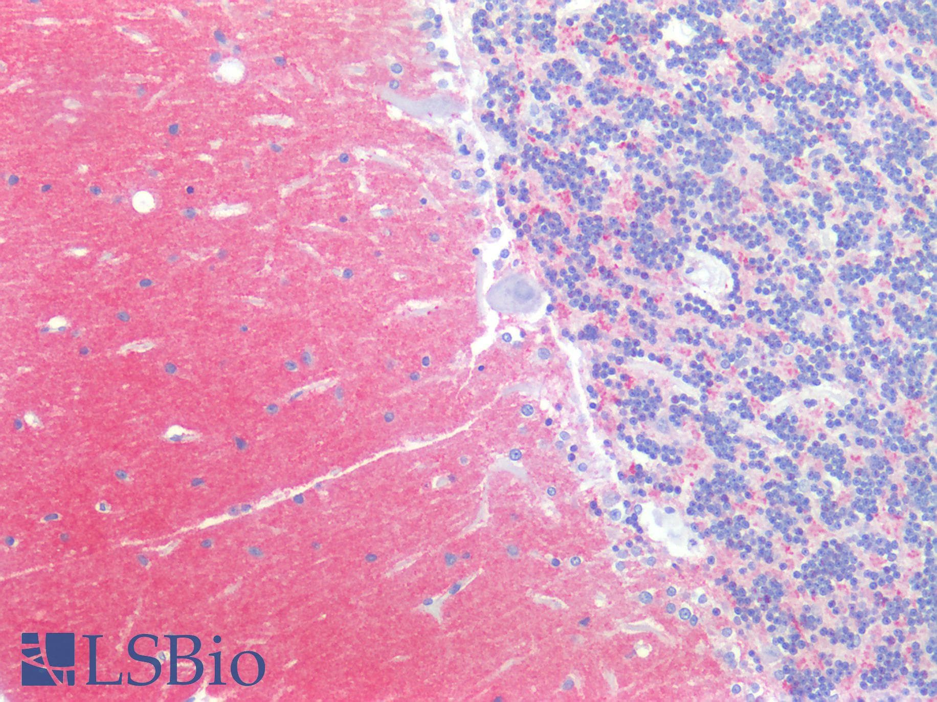 PathPlus™ SNCA / Alpha-Synuclein Antibody (aa61-95, clone 10C299)