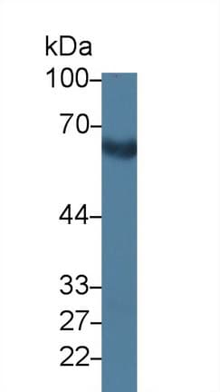 SELE / CD62E / E-selectin Antibody (aa23-240)