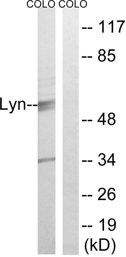 LYN Antibody (aa463-512)