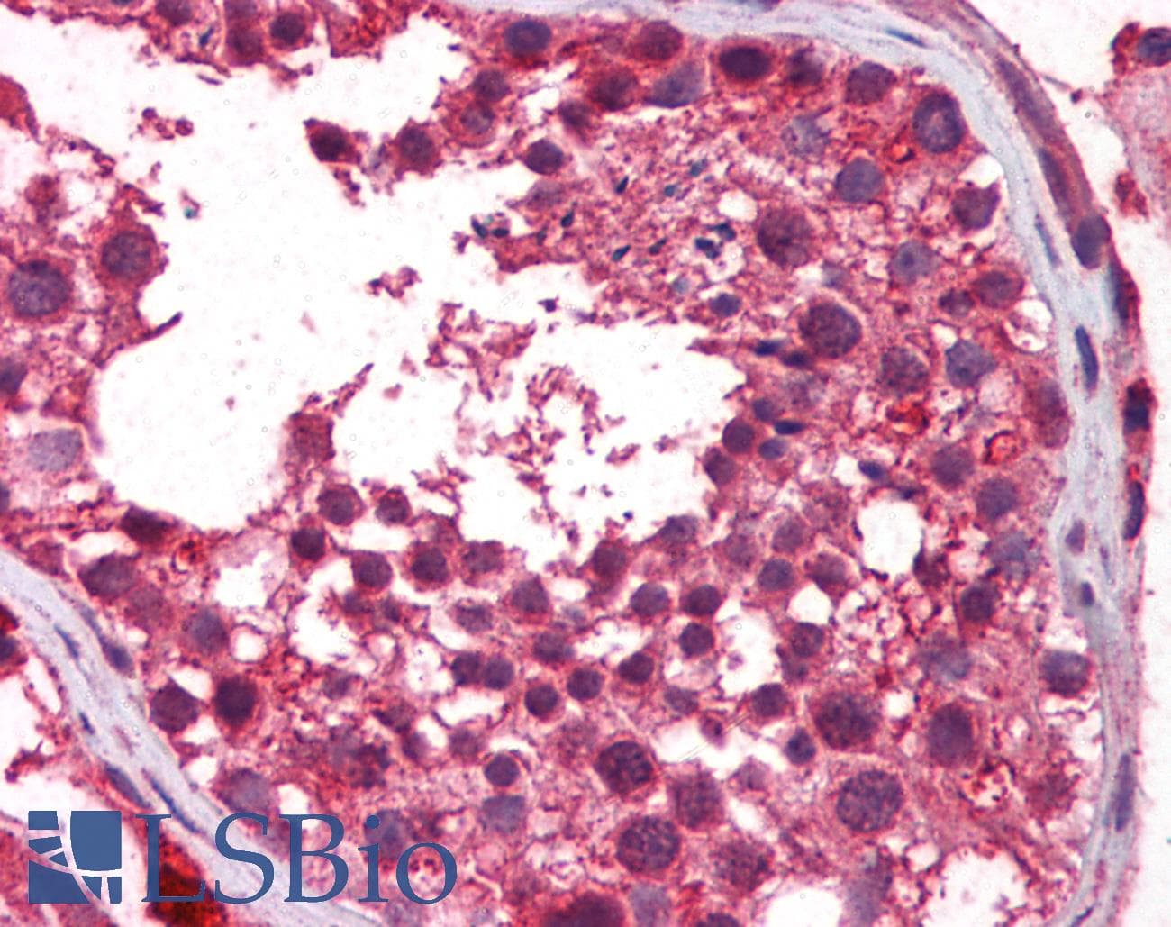 TERF2IP / RAP1 Antibody (aa142-191)