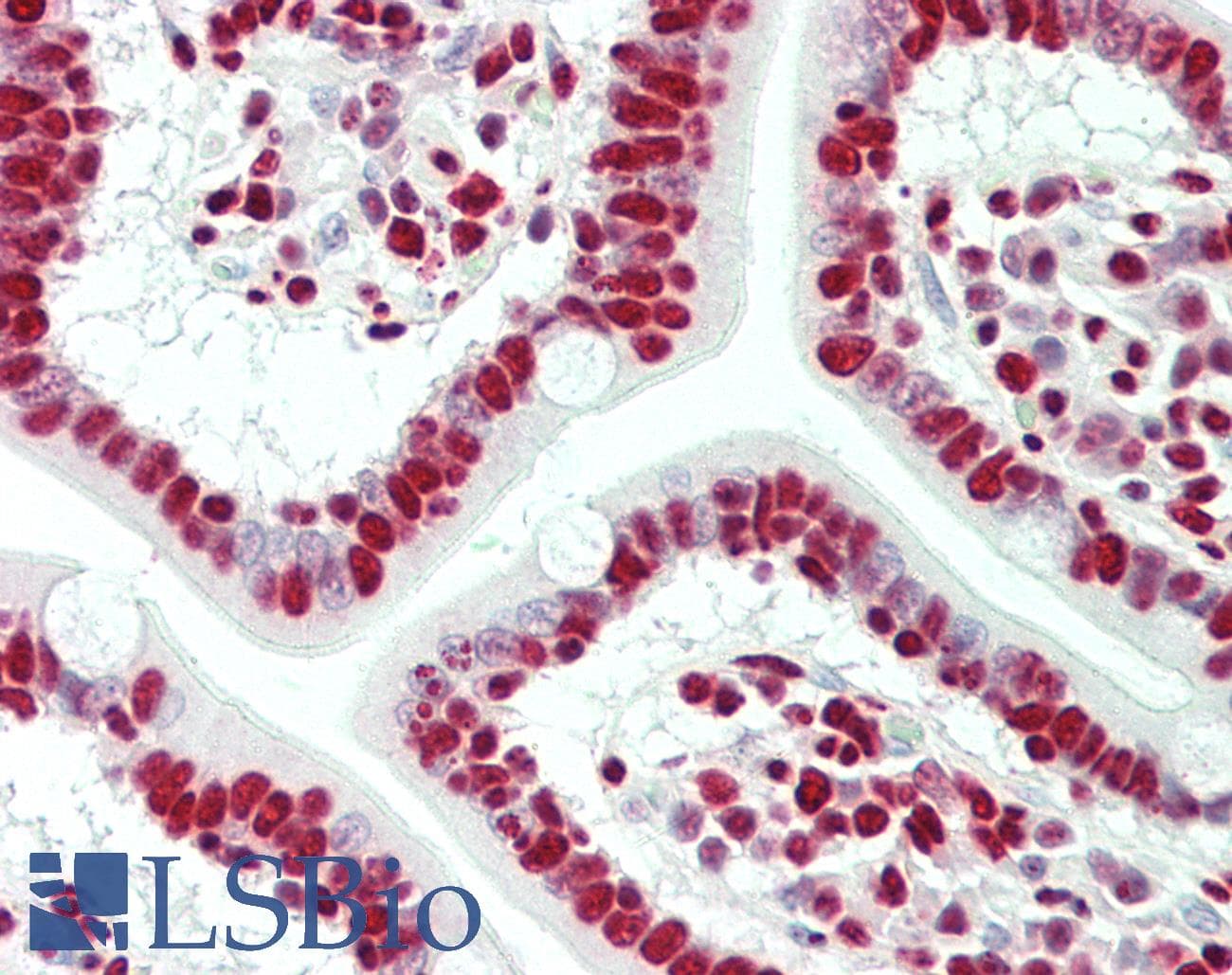 IHC-plus™ HNRNPH1 / hnRNP H Antibody (aa400-C-term)