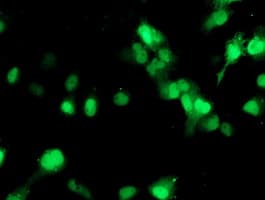SETD7 / SET7 Antibody (clone OTI2D10)
