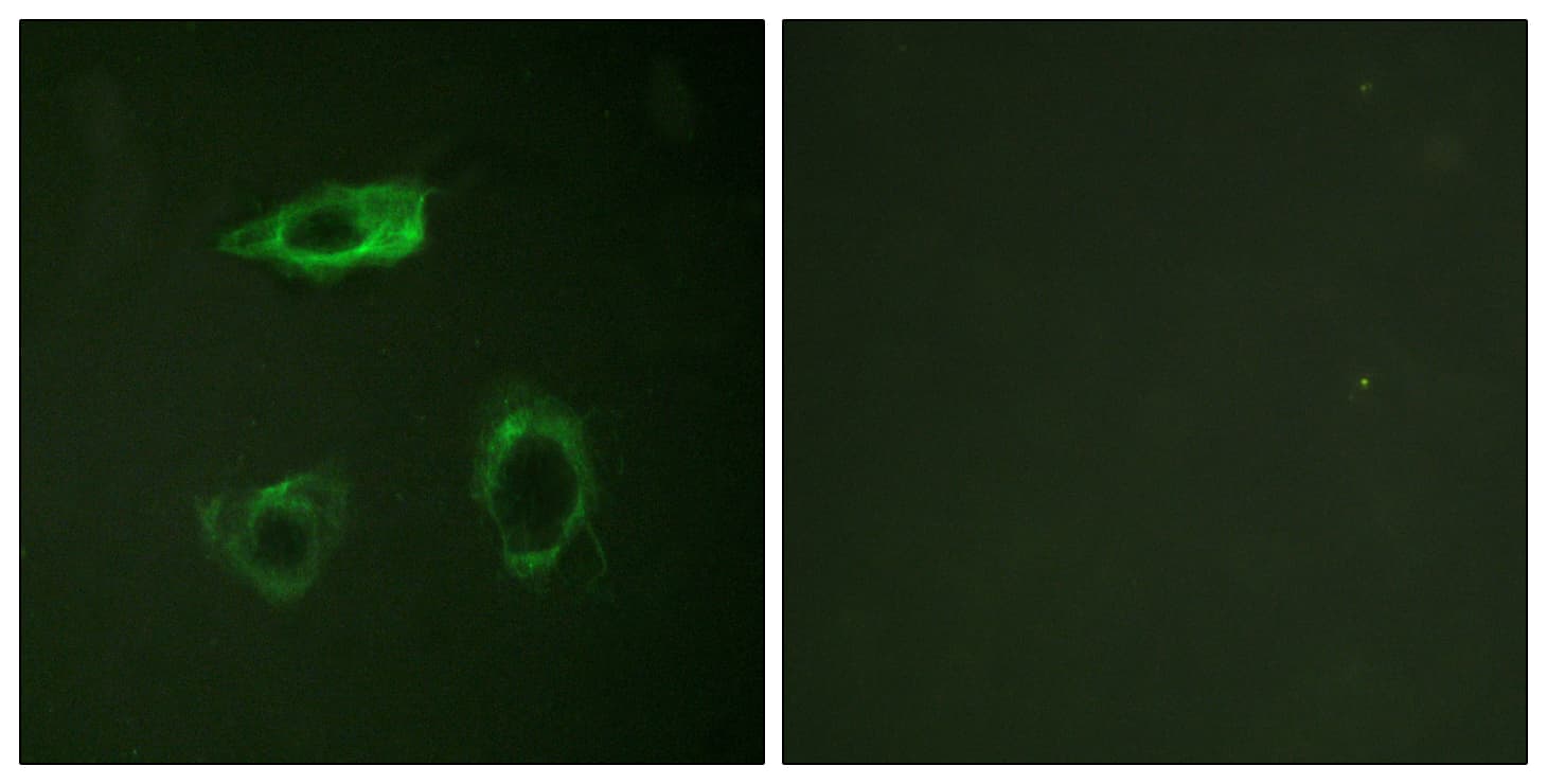 ITGB2 / CD18 Antibody (phospho-Thr758)