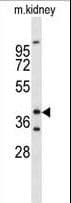 IHC-plus™ Polyclonal Rabbit anti-Human FOXL1 Antibody (aa94-119, IHC, WB)