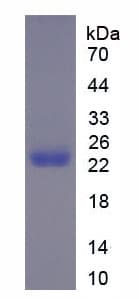 Mouse MMP12 Protein (Recombinant His)