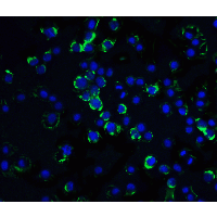 Polyclonal Rabbit anti-Human CRADD / RAIDD Antibody (IHC, IF, WB)