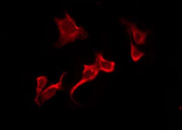 OR51B6 Antibody