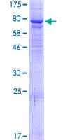 Human ELP4 Protein (Recombinant GST)