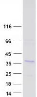 Human CHORDC1 / CHP1 Protein (Recombinant Myc-DDK (Flag))