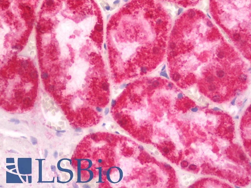 IHC-plus™ Polyclonal Rabbit anti-Human MFN1 Antibody (IHC, WB)