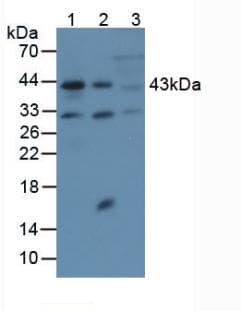 ACTA2 / Smooth Muscle Actin Antibody