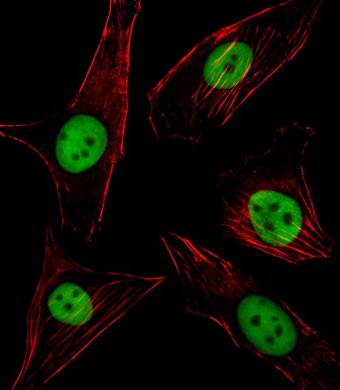 IHC-plus™ SPI1 / PU.1 Antibody (aa217-246)